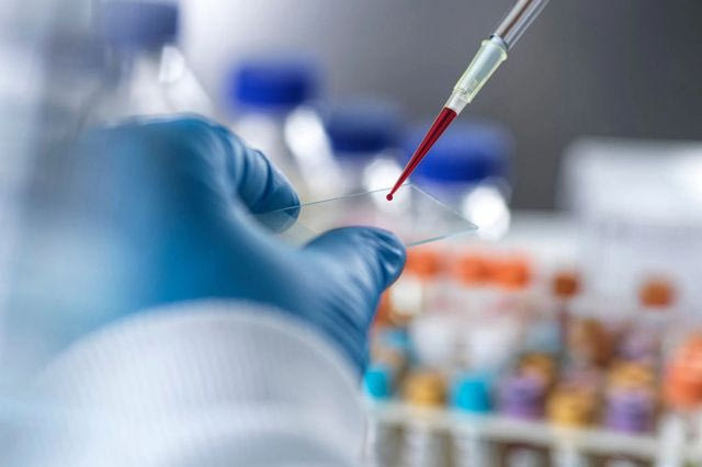 Ρωσία – πανώλη: Δεν εντοπίστηκε επικίνδυνο παθογόνο στις επαφές της 28χρονης ερευνήτριας