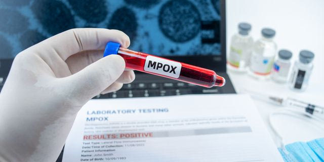 Ρωσία: Πέντε κρούσματα “ευλογιάς των πιθήκων” στην Αγία Πετρούπολη