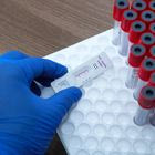Rapid test για σύφιλη
