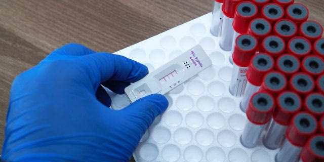 Rapid test για σύφιλη